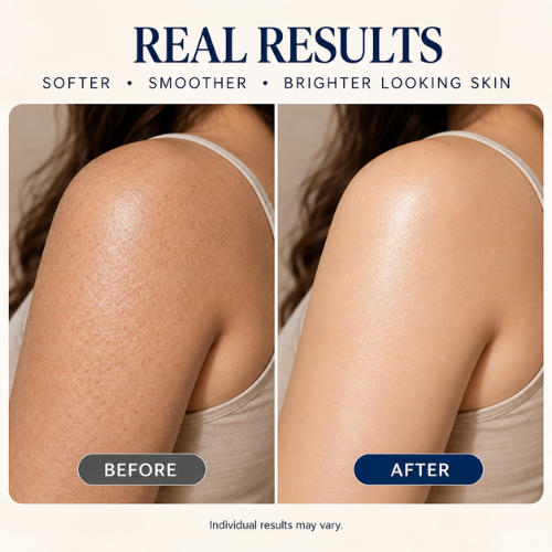 Before and after skin results: dull skin, strawberry skin, dehydrated skin, dark spots and uneven tone
